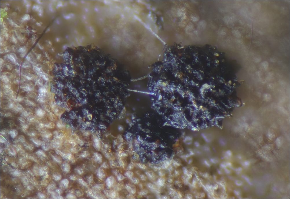 Bartheletia paradoxa auf Gingko biloba