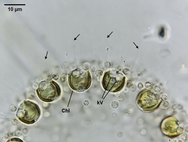 Chrysostephanosphaera globulifera eine geheimnisvolle Goldalge