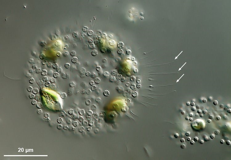 Chrysostephanosphaera globulifera eine geheimnisvolle Goldalge