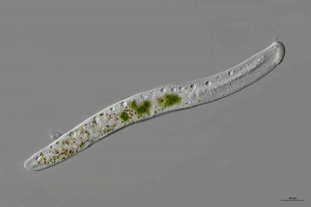 Beutefang beim Ciliaten Homalozoon vermiculare