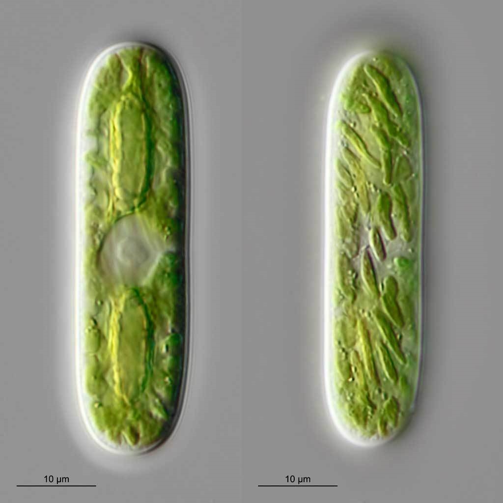 Parasitenbefall bei Cylindrocystis brebissonii