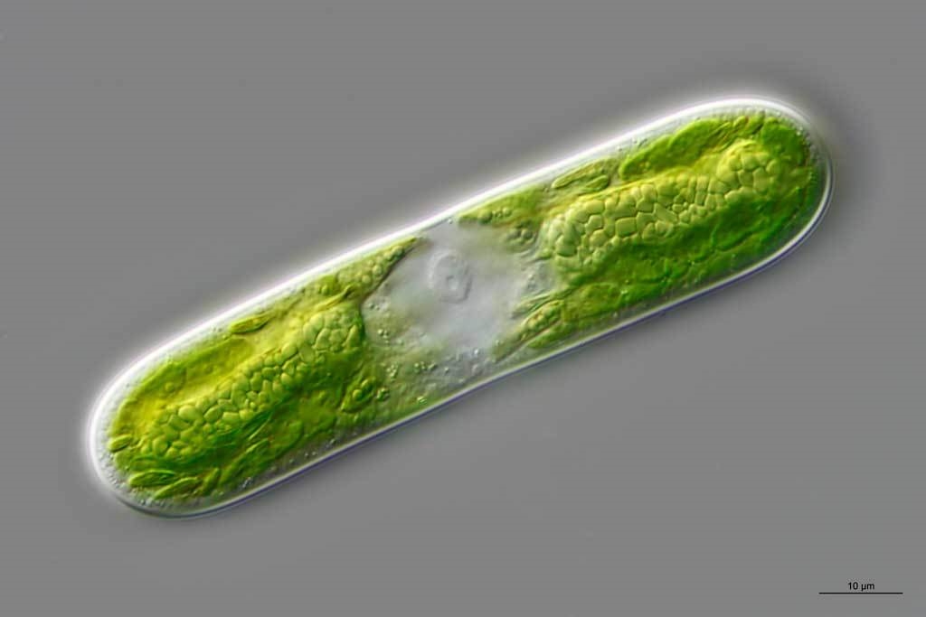 Parasitenbefall bei Cylindrocystis brebissonii