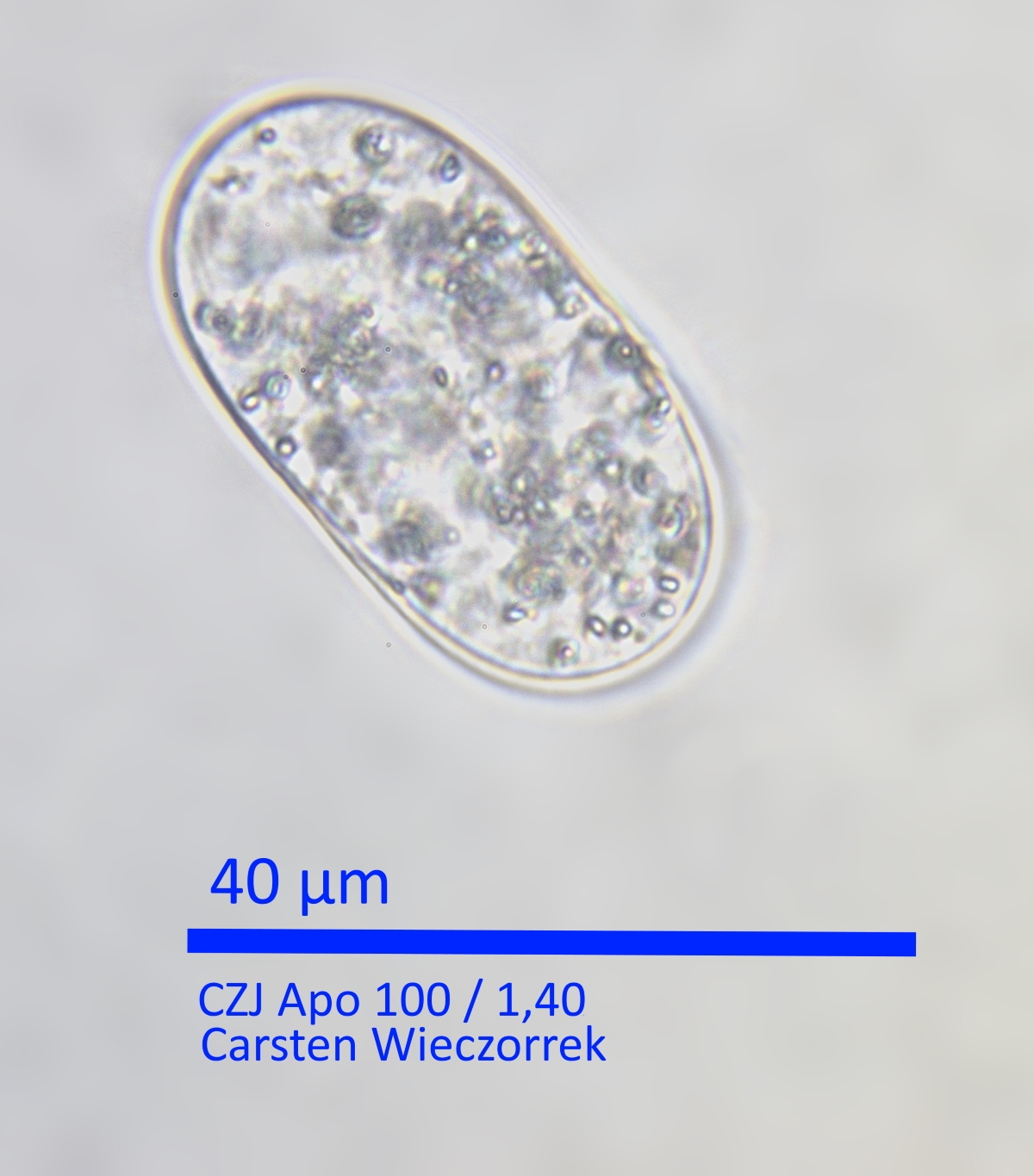Achromatium oxaliferum Nachschlag