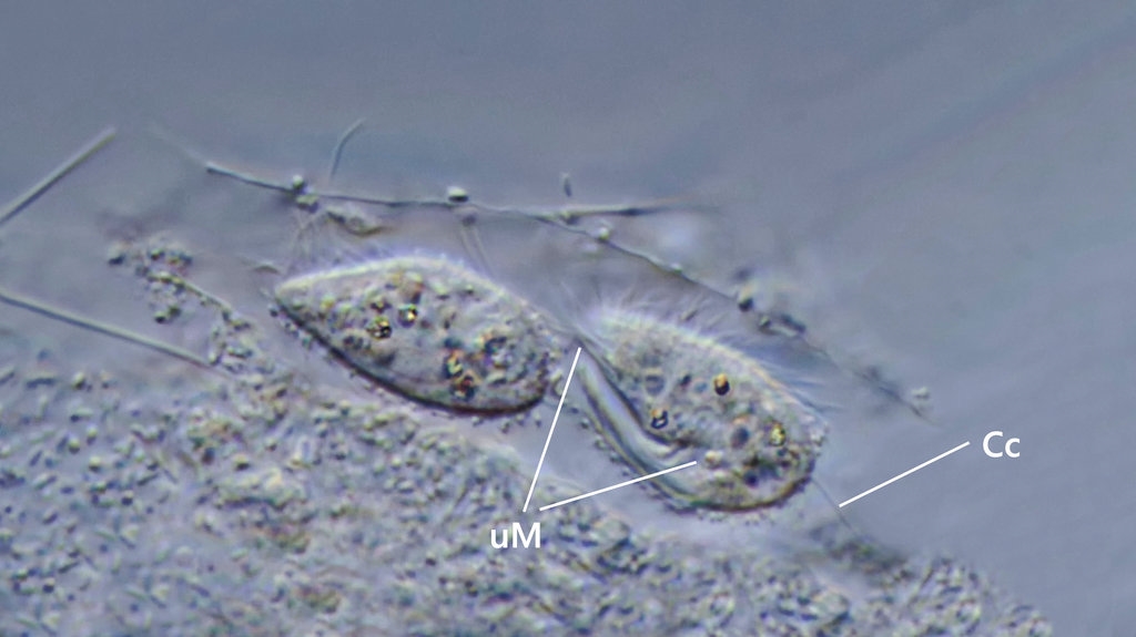 Ein kleiner Ciliat Calyptotricha lanuginosa