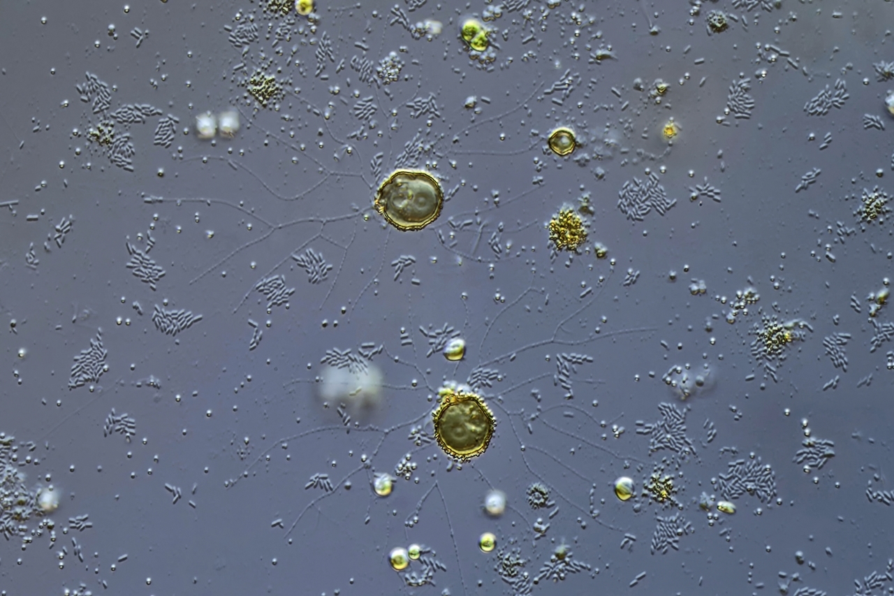 Microgromia Artenvielfalt oder Varabilität