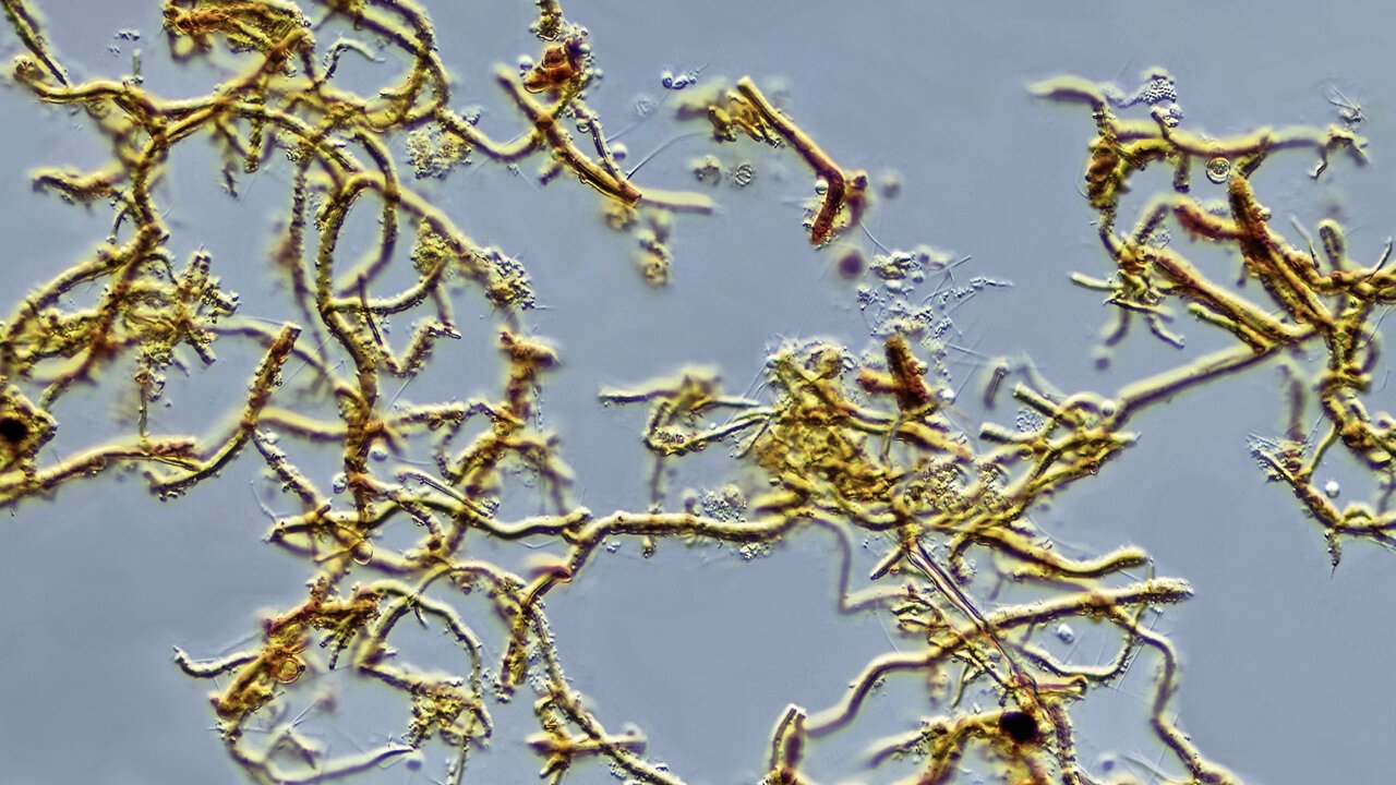 Ockerbakterium Leptothrix ochracea