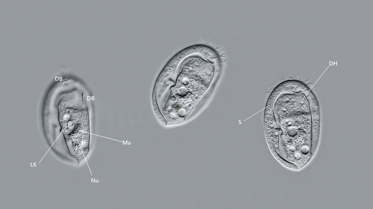 Gastronauta membranaceus Ein eher seltener Ciliat